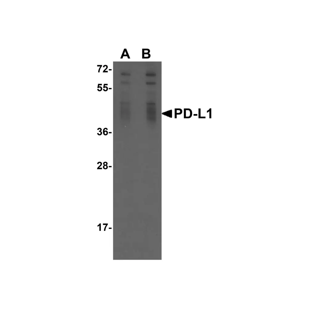 ProSci RF16035 PDL1 Antibody [6H10], ProSci, 0.1 mg/Unit Primary Image