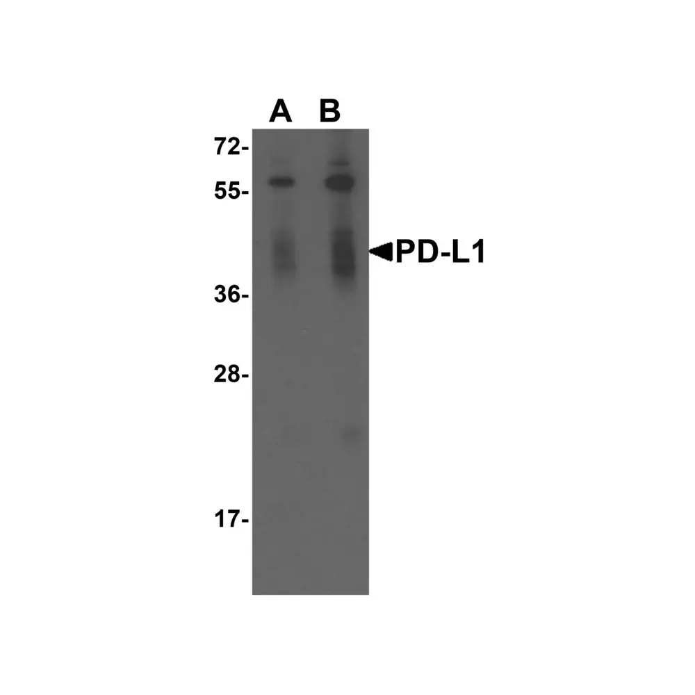 ProSci RF16036 PDL1 Antibody [2D6], ProSci, 0.1 mg/Unit Primary Image