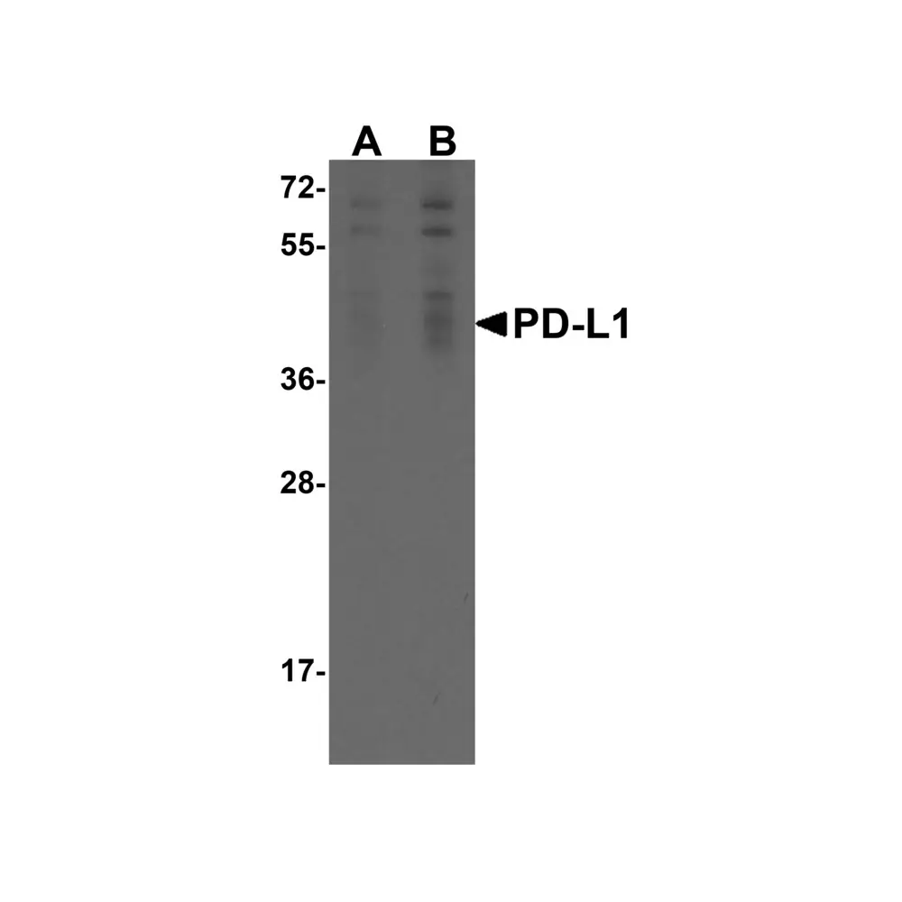 ProSci RF16038_S PDL1 Antibody [1D7], ProSci, 0.02 mg/Unit Primary Image