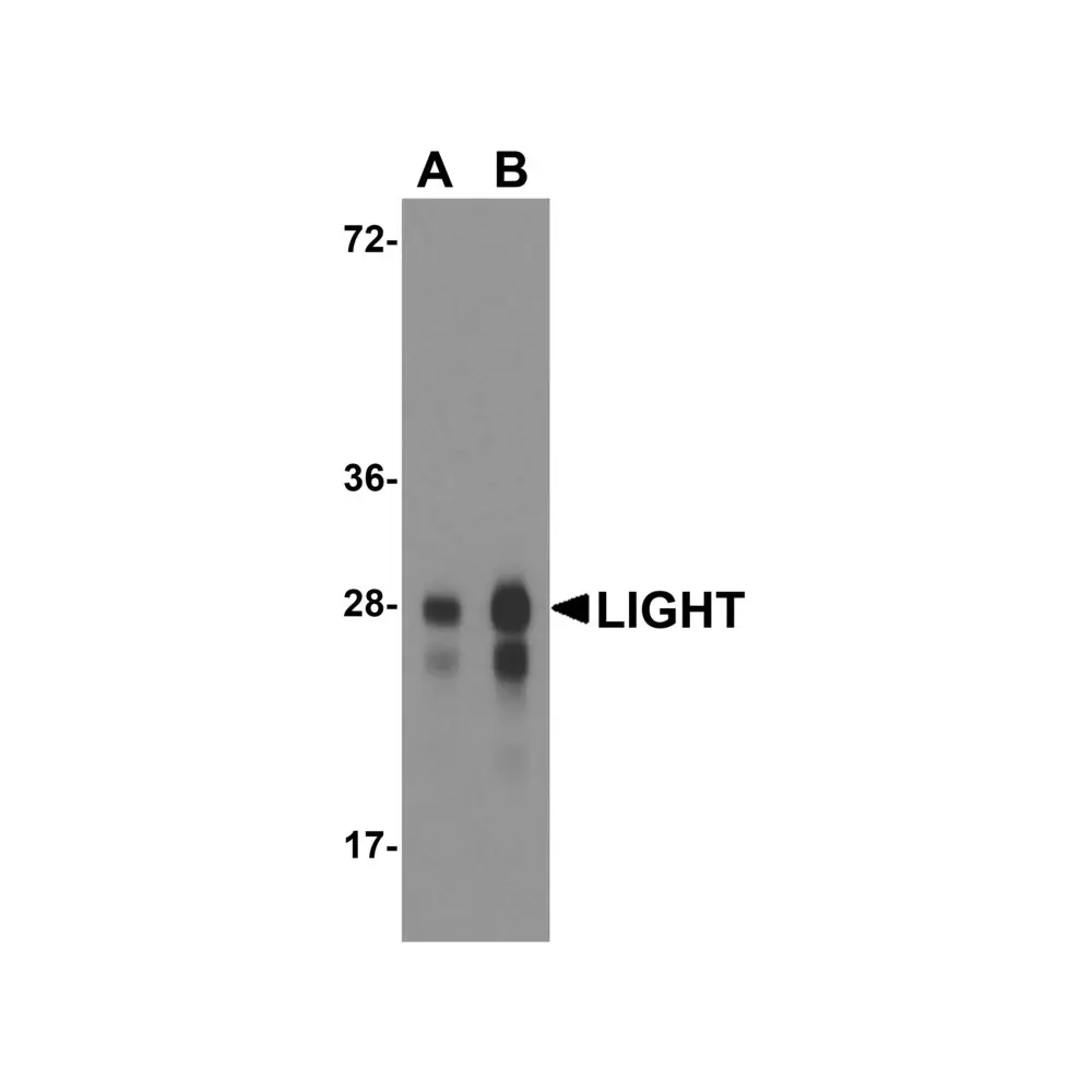 ProSci RF16061 LIGHT Antibody [7B9F12], ProSci, 0.1 mg/Unit Primary Image