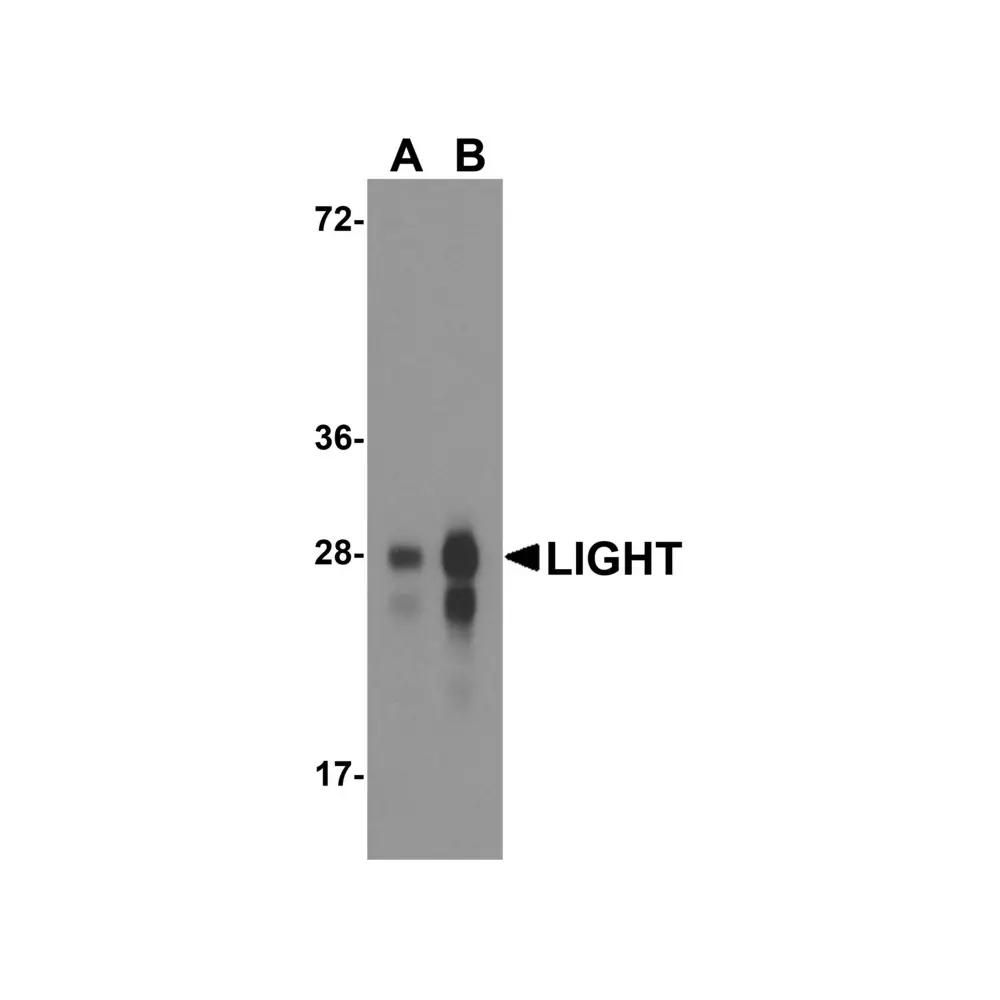ProSci RF16062 LIGHT Antibody [7B9H9], ProSci, 0.1 mg/Unit Primary Image