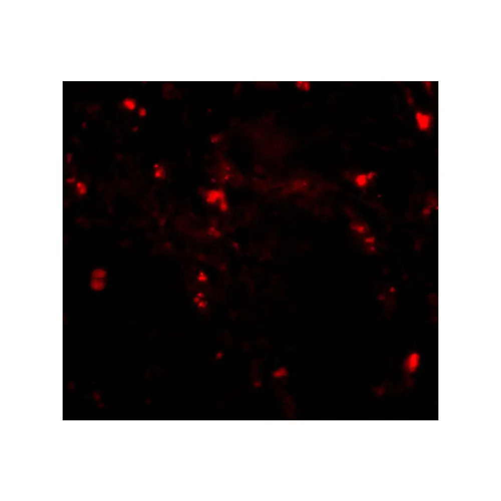 ProSci 4585_S RGPD5 Antibody, ProSci, 0.02 mg/Unit Tertiary Image
