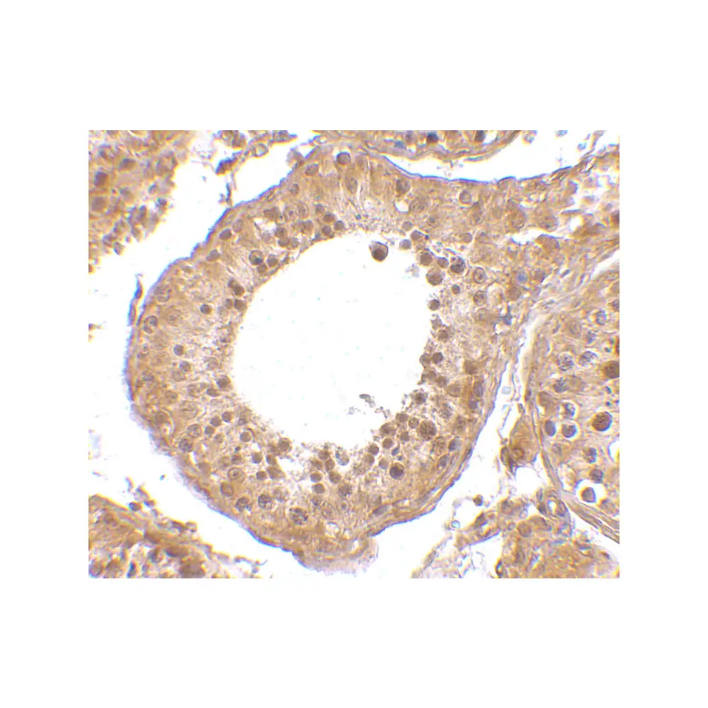 ProSci 4585 RGPD5 Antibody, ProSci, 0.1 mg/Unit Secondary Image