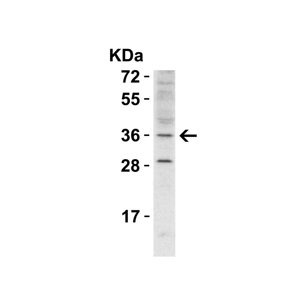 ProSci 5525 RHBDD1 Antibody, ProSci, 0.1 mg/Unit Secondary Image