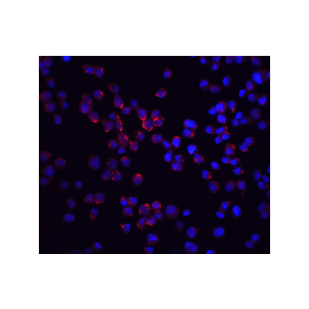 ProSci 2075_S RICK Antibody, ProSci, 0.02 mg/Unit Quaternary Image
