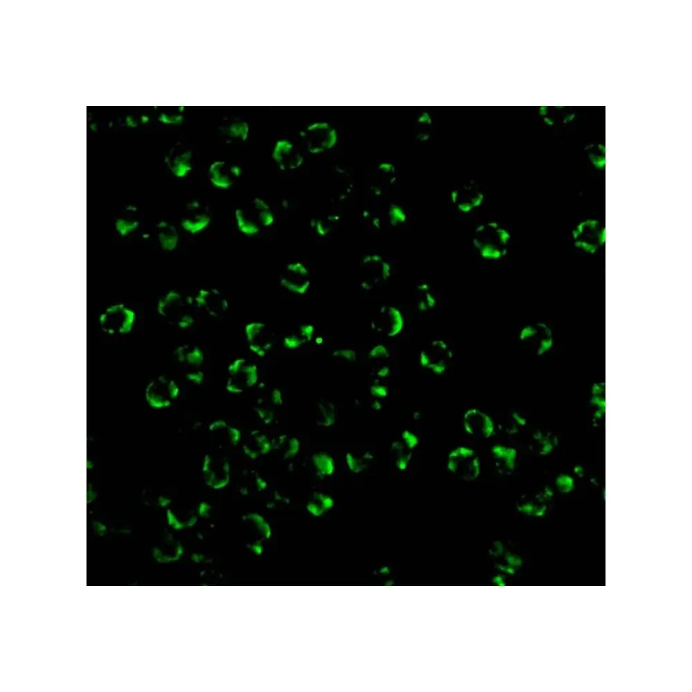 ProSci 2183 RICK Antibody, ProSci, 0.1 mg/Unit Tertiary Image