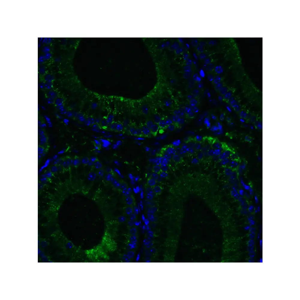 ProSci 3953 RIG-1 Antibody, ProSci, 0.1 mg/Unit Senary Image