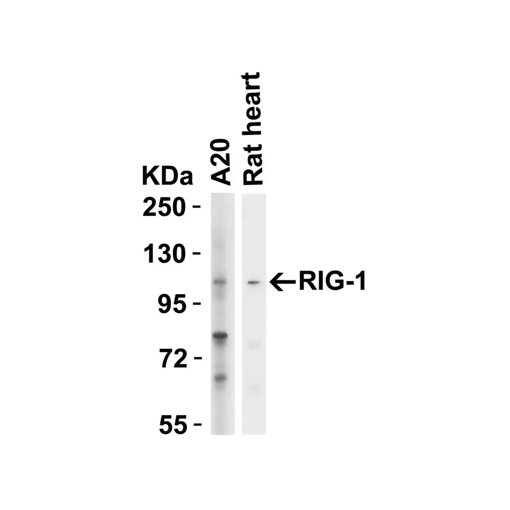 ProSci 3953 RIG-1 Antibody, ProSci, 0.1 mg/Unit Primary Image