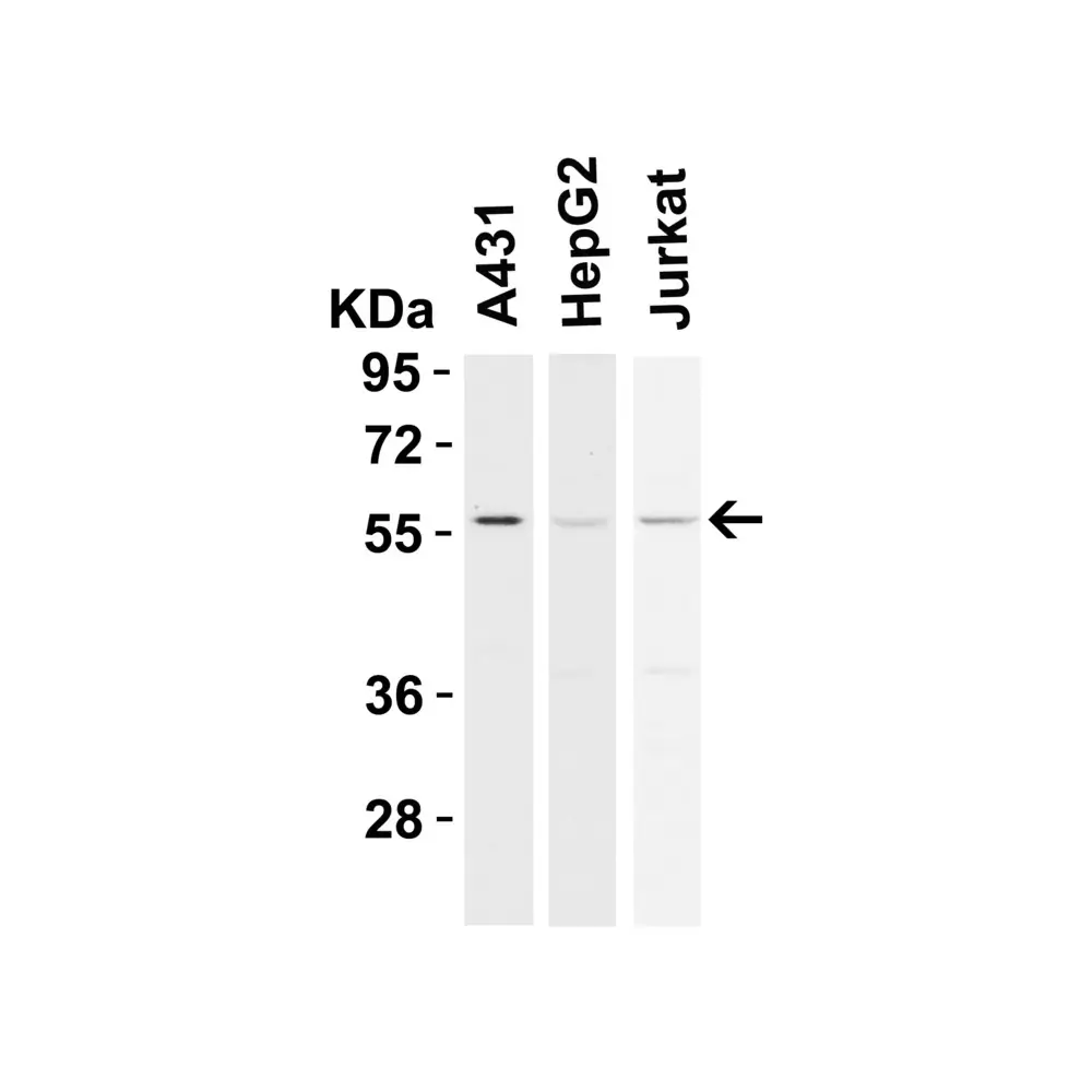 ProSci 2283 RIP3 Antibody, ProSci, 0.1 mg/Unit Primary Image