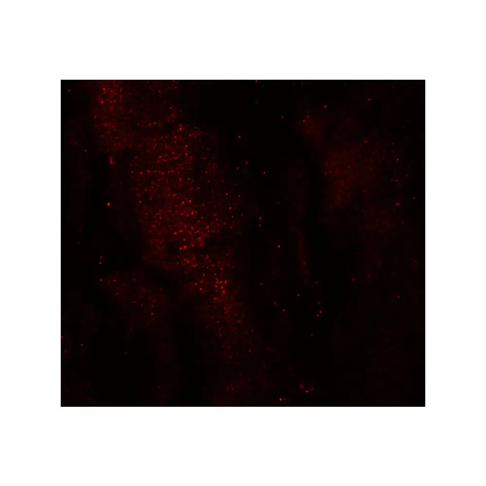 ProSci 6641_S RKHD3 Antibody, ProSci, 0.02 mg/Unit Secondary Image