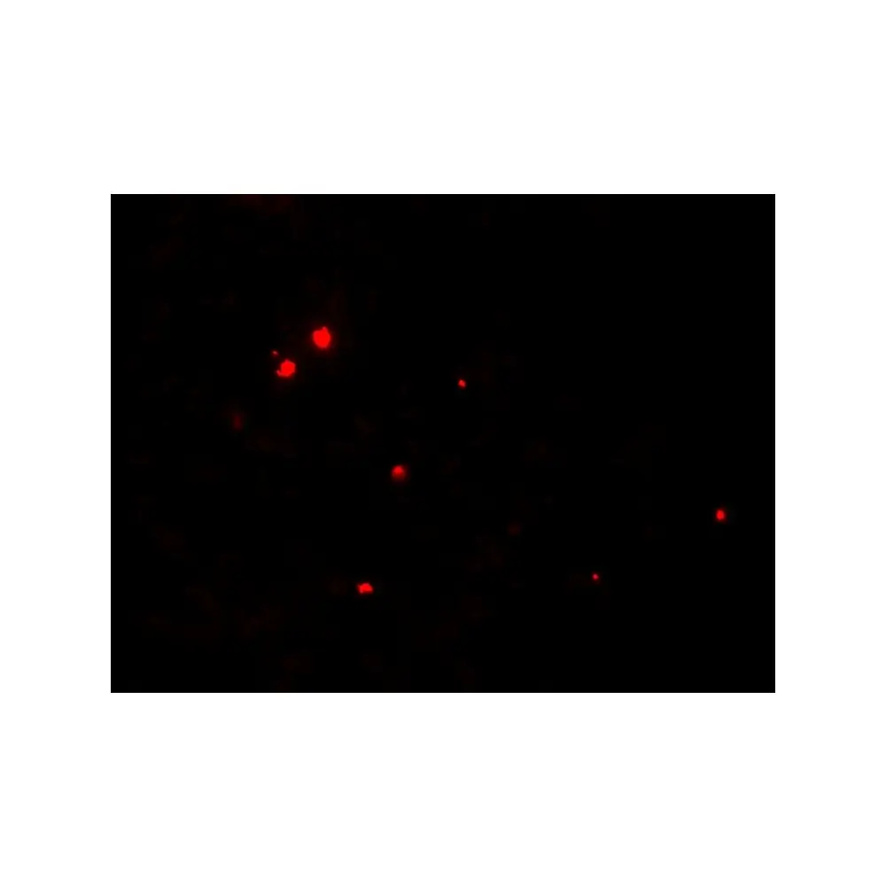 ProSci 6763_S RNASET2 Antibody, ProSci, 0.02 mg/Unit Tertiary Image