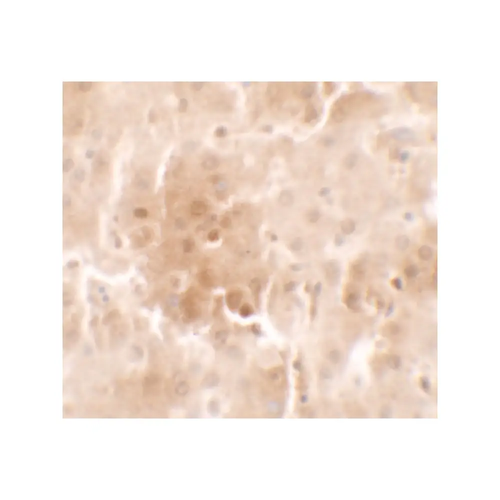 ProSci 7357 RNF20 Antibody, ProSci, 0.1 mg/Unit Secondary Image