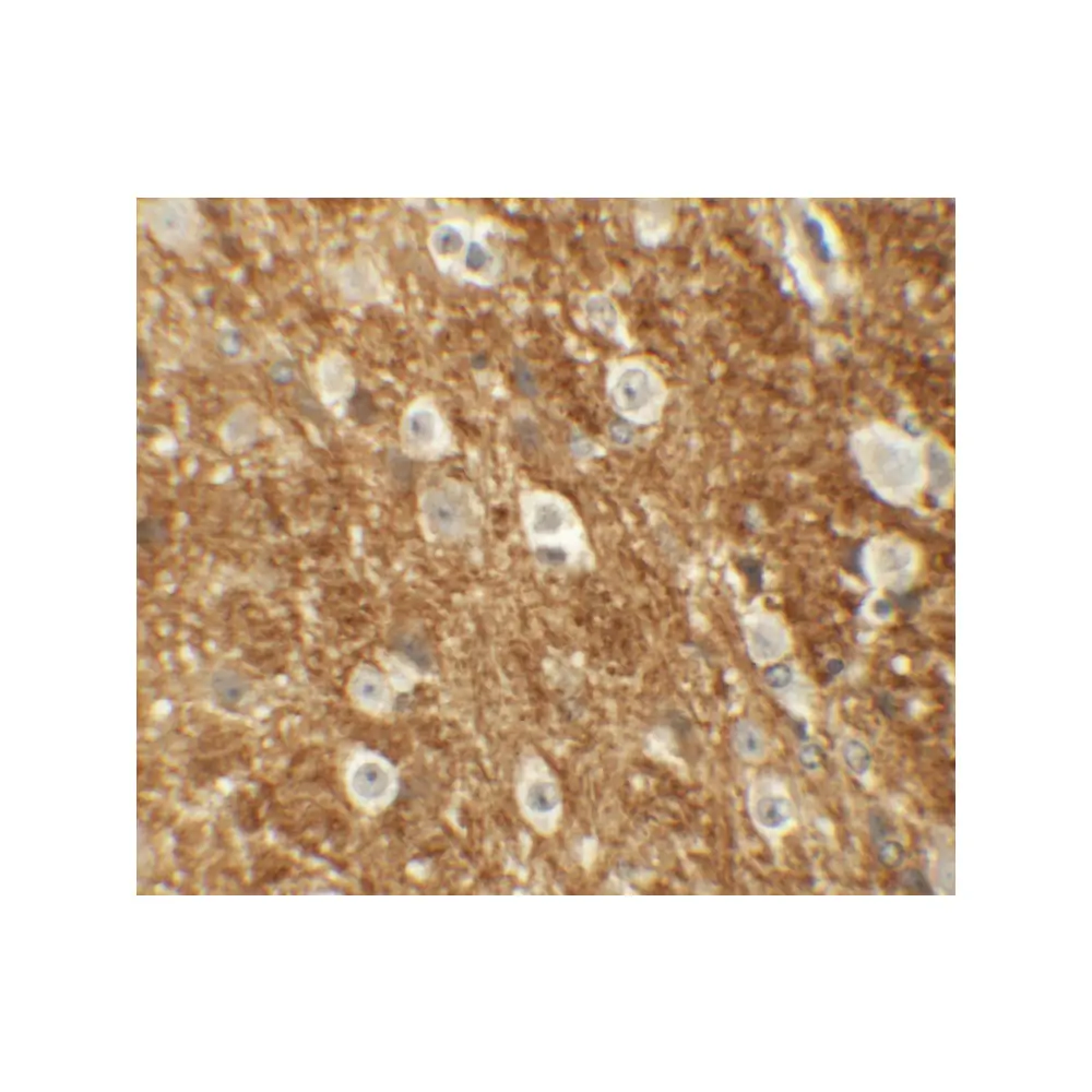 ProSci 6297 ROCK2 Antibody, ProSci, 0.1 mg/Unit Secondary Image