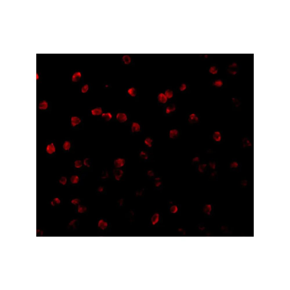 ProSci 3511_S RPS6K1 Antibody, ProSci, 0.02 mg/Unit Tertiary Image