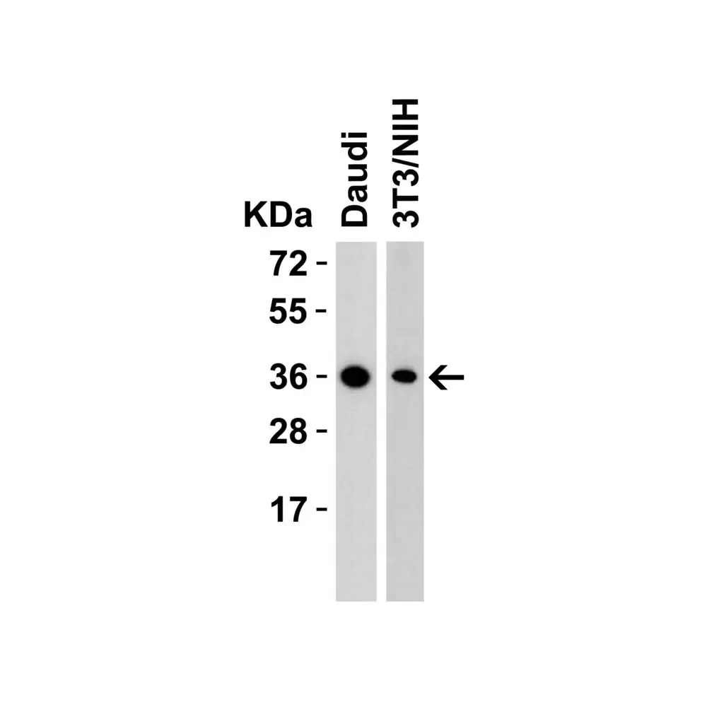 ProSci 5171 RSPO1 Antibody, ProSci, 0.1 mg/Unit Primary Image