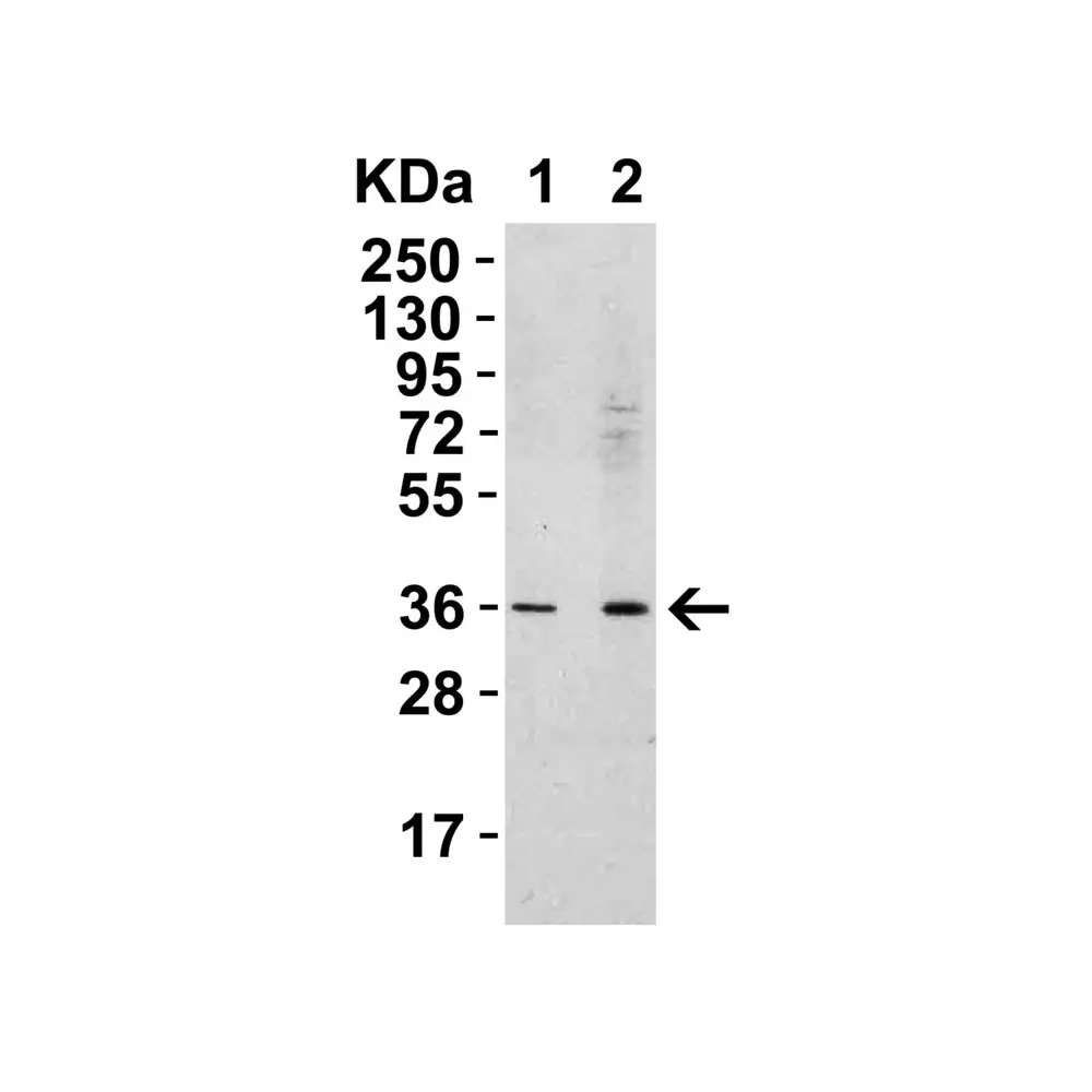 ProSci 5171 RSPO1 Antibody, ProSci, 0.1 mg/Unit Tertiary Image
