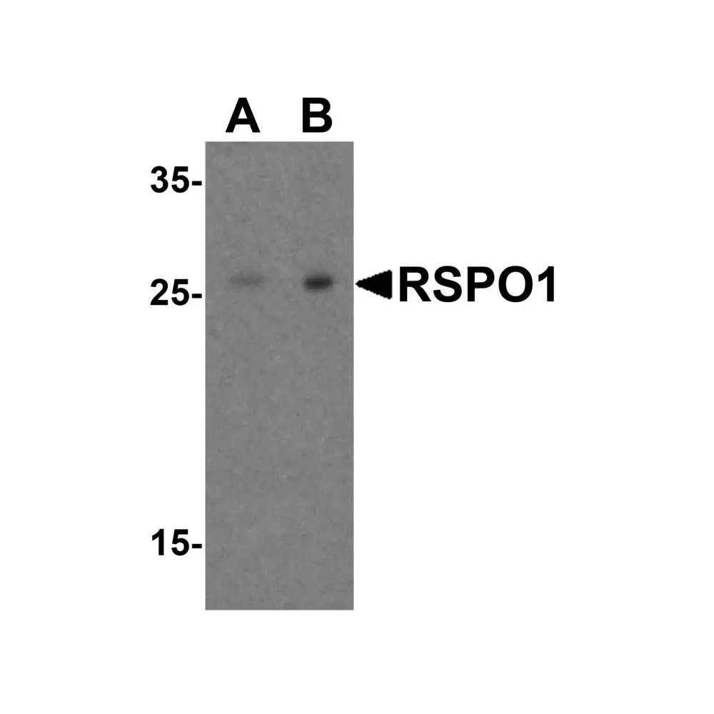 ProSci 5171_S RSPO1 Antibody, ProSci, 0.02 mg/Unit Quaternary Image
