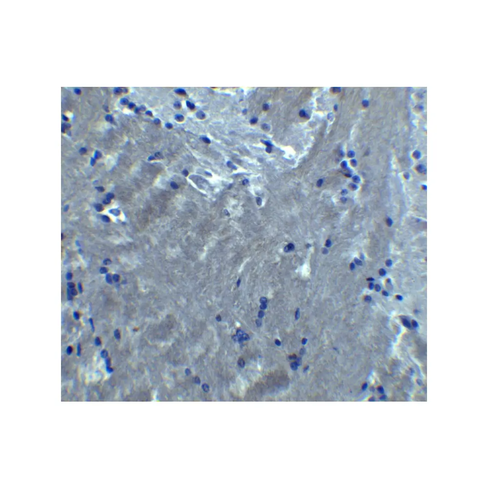 ProSci 8229 S1PR2 Antibody, ProSci, 0.1 mg/Unit Secondary Image