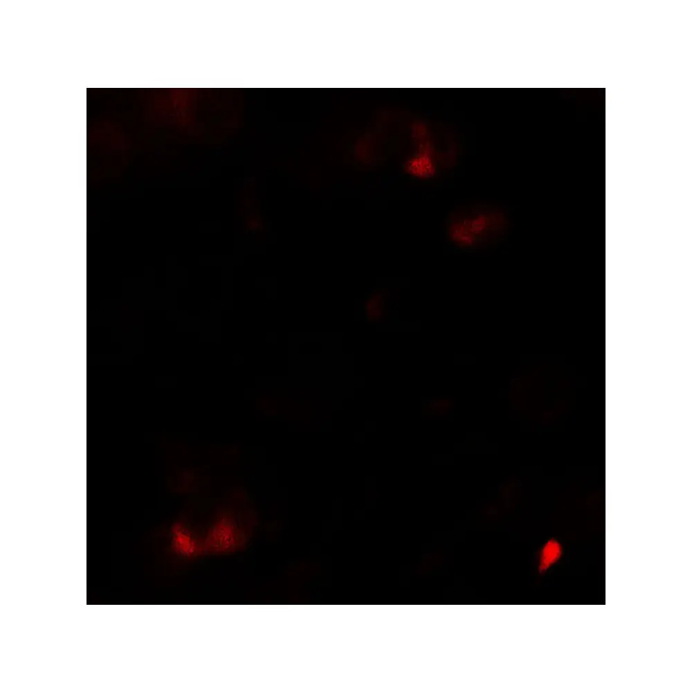 ProSci 7079_S SAMSN Antibody, ProSci, 0.02 mg/Unit Tertiary Image