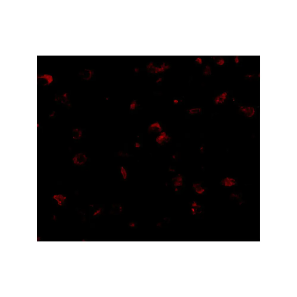 ProSci 4623 SAPAP1 Antibody, ProSci, 0.1 mg/Unit Tertiary Image