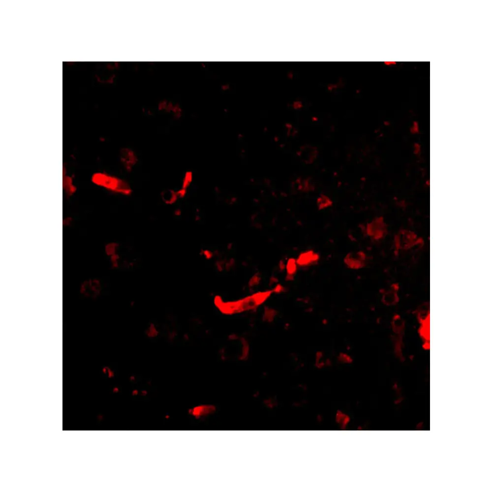 ProSci 4625_S SAPAP2 Antibody, ProSci, 0.02 mg/Unit Tertiary Image