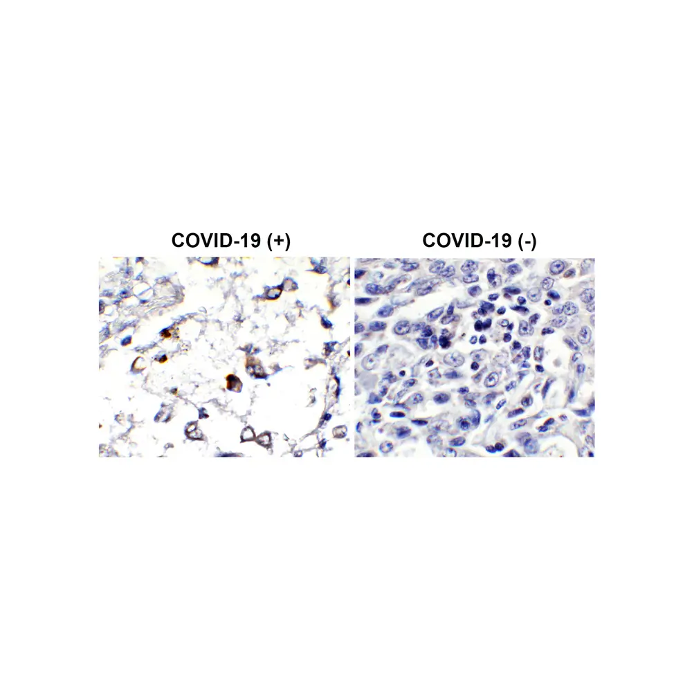 ProSci 9157-HRP SARS-CoV-2 (COVID-19) Membrane Antibody (HRP), ProSci, 0.1 mg/Unit Primary Image