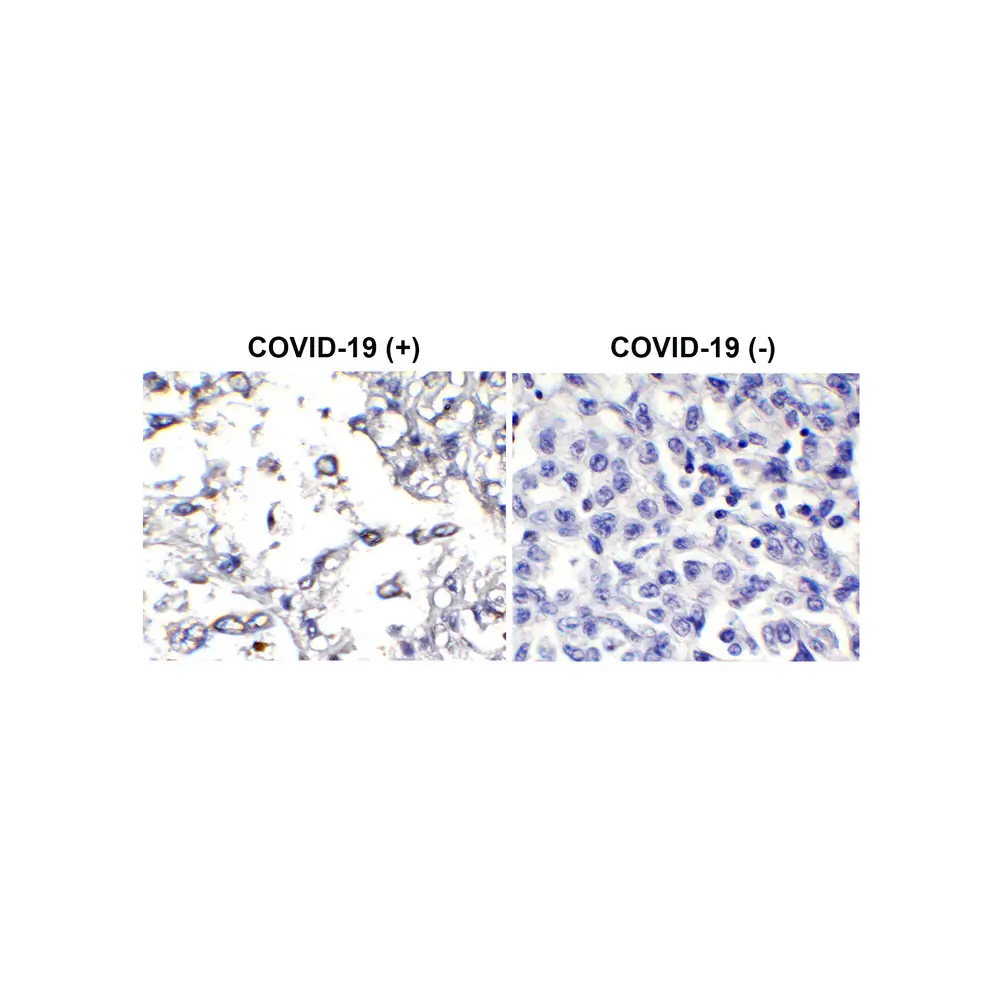 ProSci 9157-biotin_S SARS-CoV-2 (COVID-19) Membrane Antibody (biotin), ProSci, 0.02 mg/Unit Secondary Image