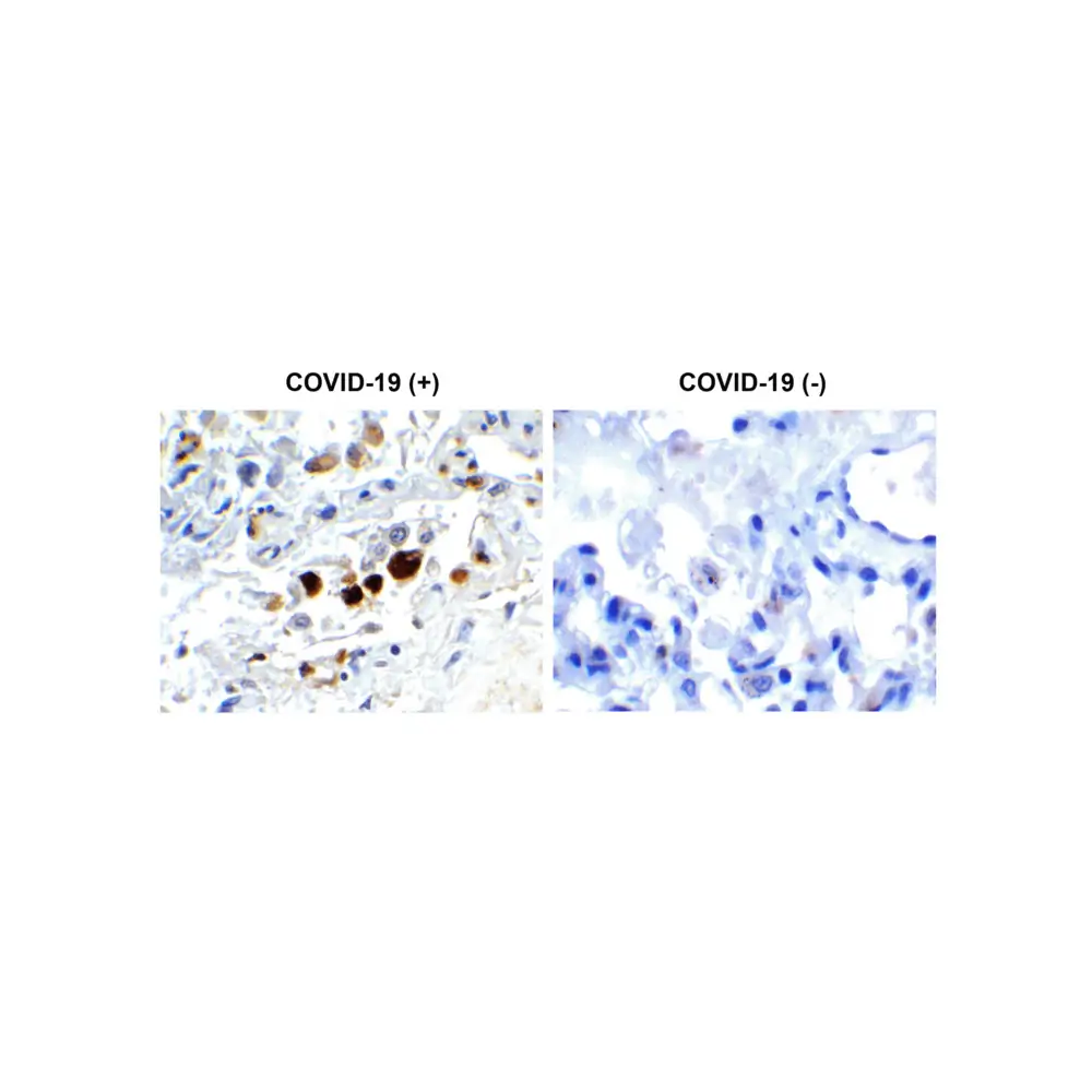 ProSci 9157 SARS-CoV-2 (COVID-19) Membrane Antibody, ProSci, 0.1 mg/Unit Primary Image