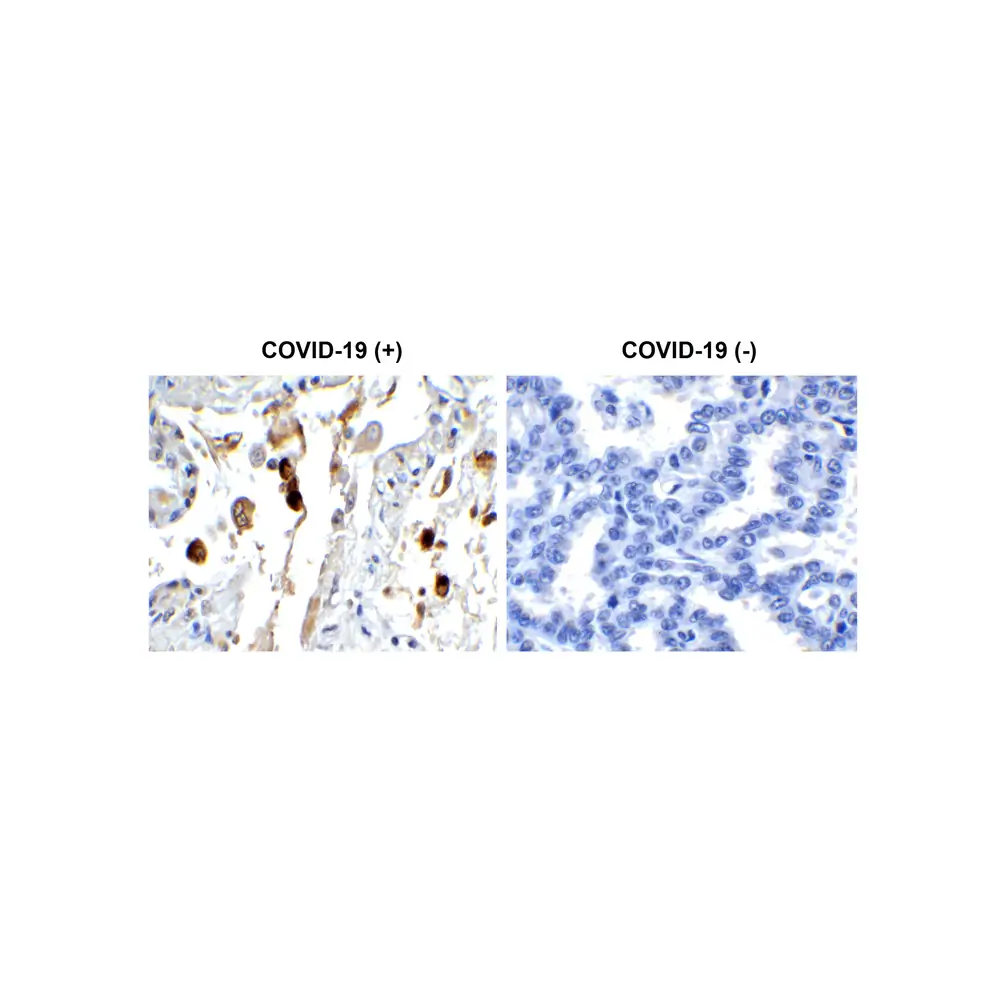 ProSci 9165 SARS-CoV-2 (COVID-19) Membrane Antibody, ProSci, 0.1 mg/Unit Primary Image