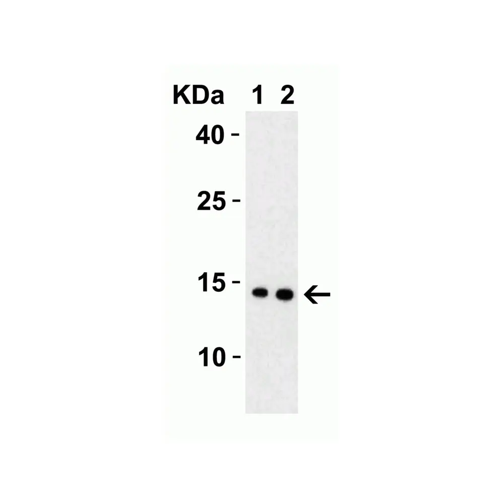 ProSci 9157 SARS-CoV-2 (COVID-19) Membrane Antibody, ProSci, 0.1 mg/Unit Tertiary Image