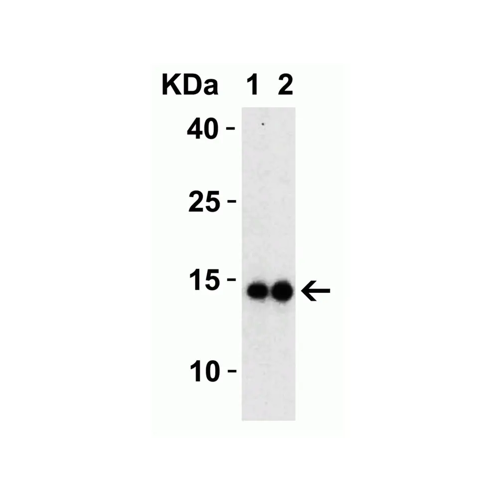 ProSci 9165_S SARS-CoV-2 (COVID-19) Membrane Antibody, ProSci, 0.02 mg/Unit Tertiary Image