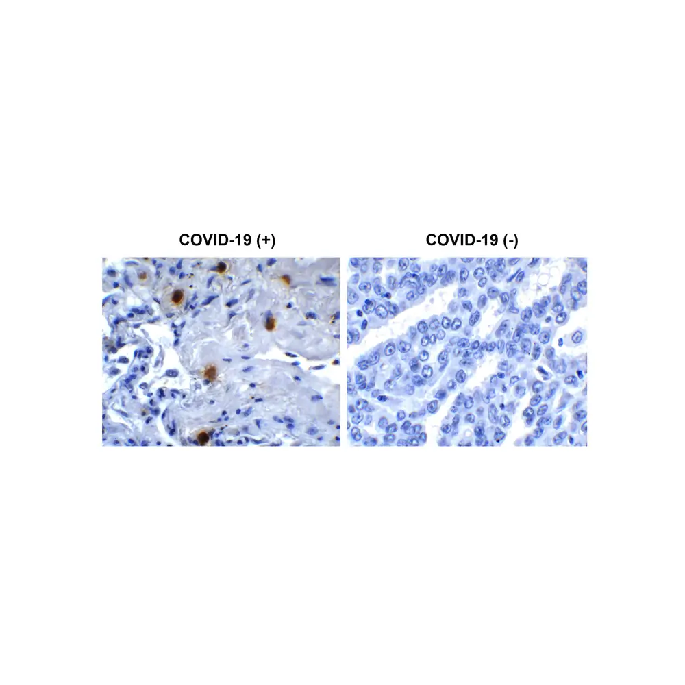 ProSci 9179 SARS-CoV-2 (COVID-19) NSP10 Antibody, ProSci, 0.1 mg/Unit Primary Image
