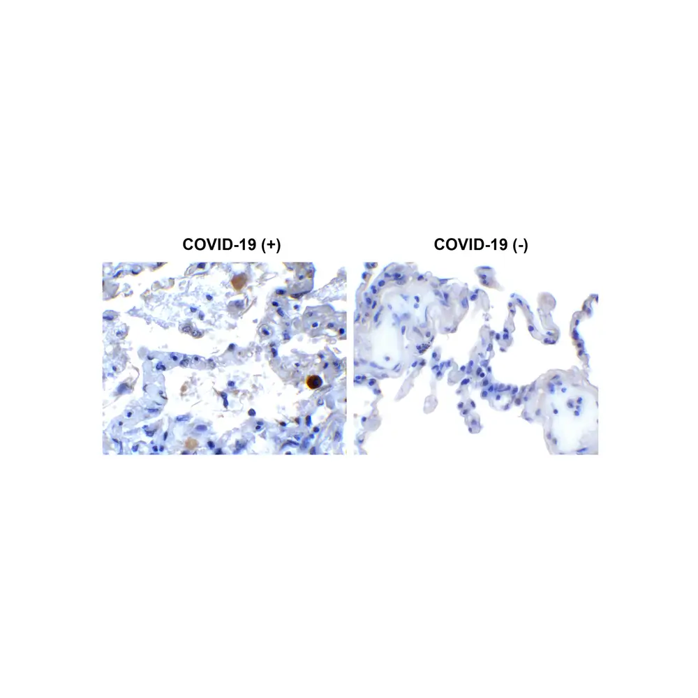 ProSci 9181_S SARS-CoV-2 (COVID-19) NSP13 (Helicase) Antibody, ProSci, 0.02 mg/Unit Primary Image