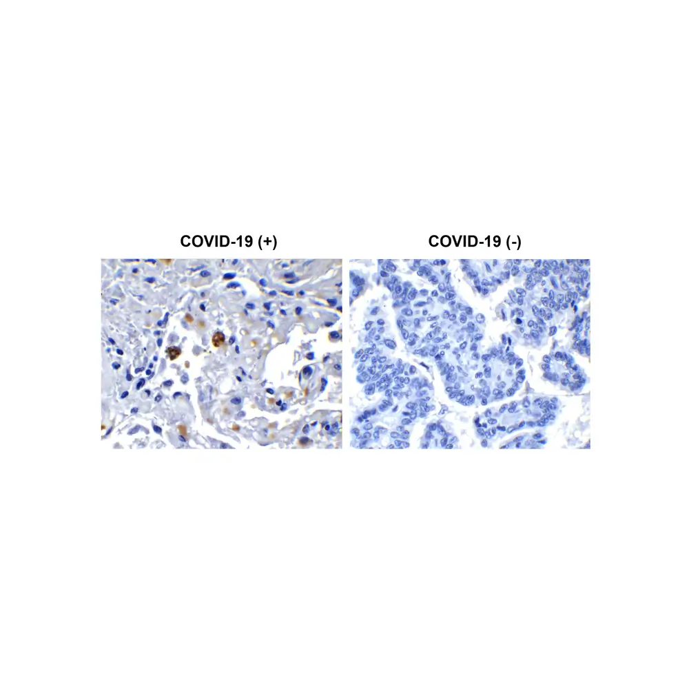 ProSci 9183 SARS-CoV-2 (COVID-19) NSP13 (Helicase) Antibody, ProSci, 0.1 mg/Unit Primary Image