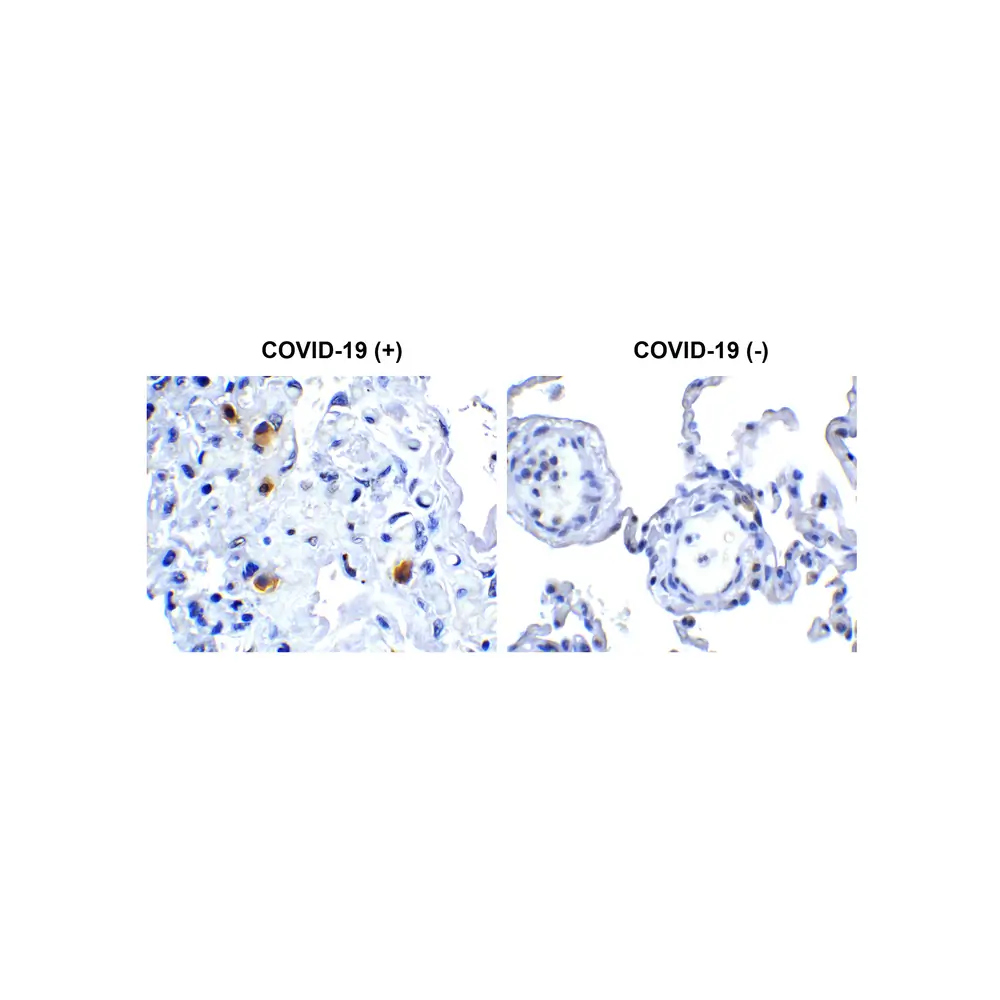 ProSci 9185_S SARS-CoV-2 (COVID-19) NSP14 (ExoN) Antibody, ProSci, 0.02 mg/Unit Primary Image