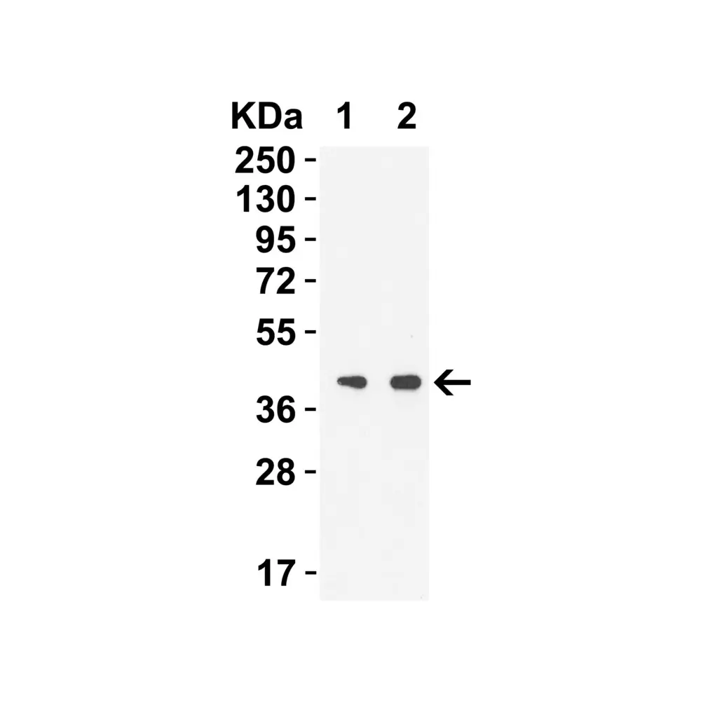 ProSci 9269 SARS-CoV-2 (COVID-19) NSP15 Antibody, ProSci, 0.1 mg/Unit Secondary Image