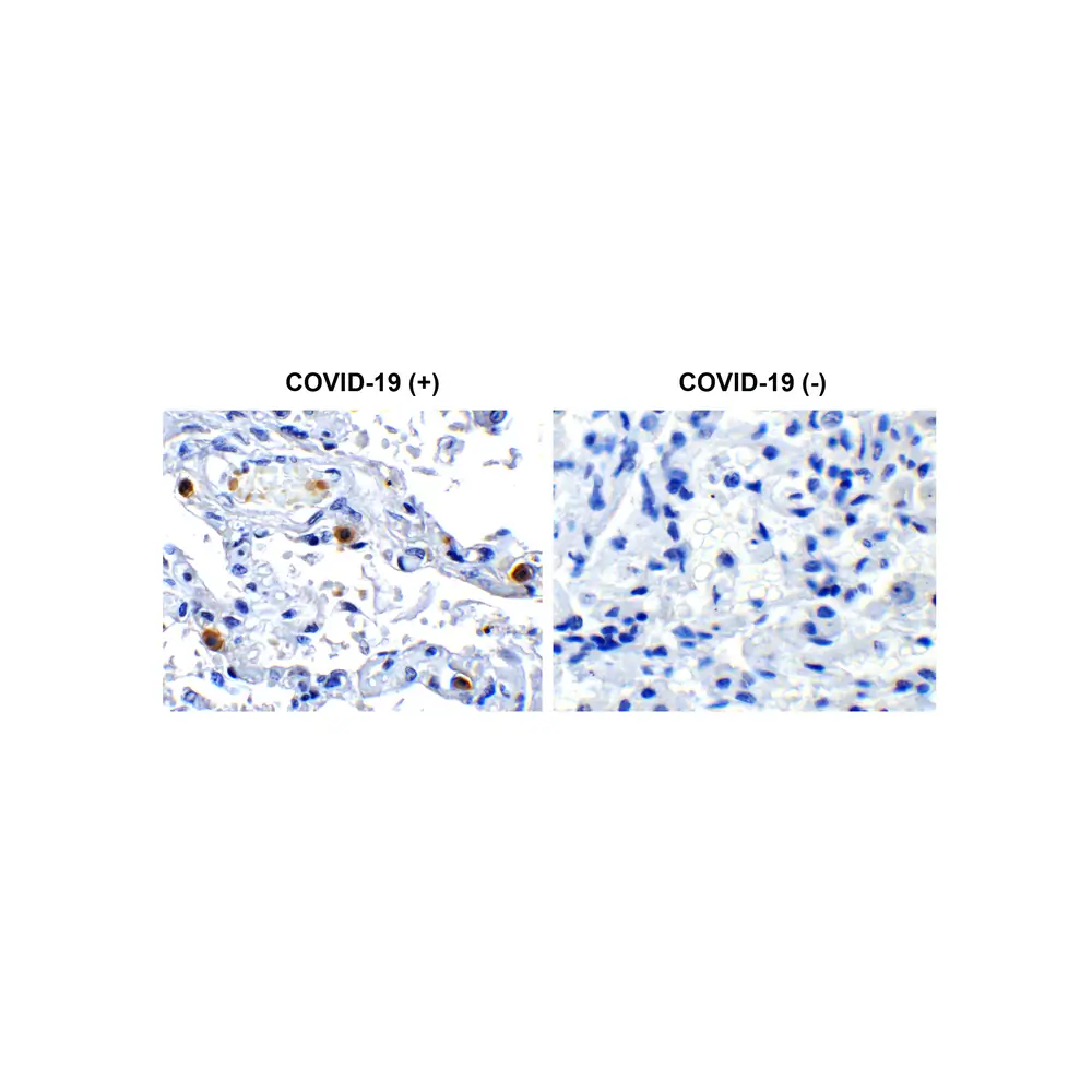 ProSci 9271_S SARS-CoV-2 (COVID-19) NSP16 Antibody, ProSci, 0.02 mg/Unit Primary Image