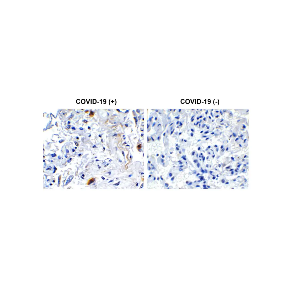 ProSci 9173 SARS-CoV-2 (COVID-19) NSP2 Antibody, ProSci, 0.1 mg/Unit Primary Image