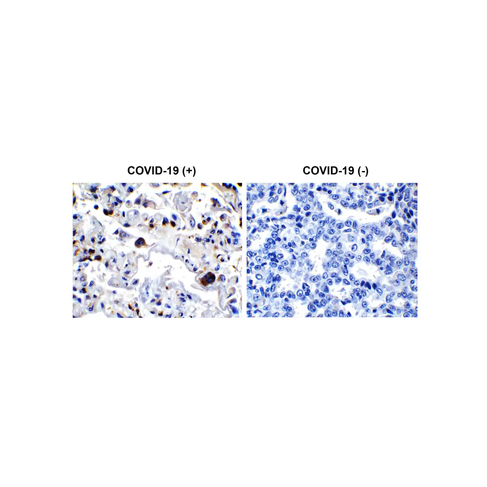 ProSci 9153 SARS-CoV-2 (COVID-19) 3CL-PRO (NSP5) Antibody, ProSci, 0.1 mg/Unit Primary Image