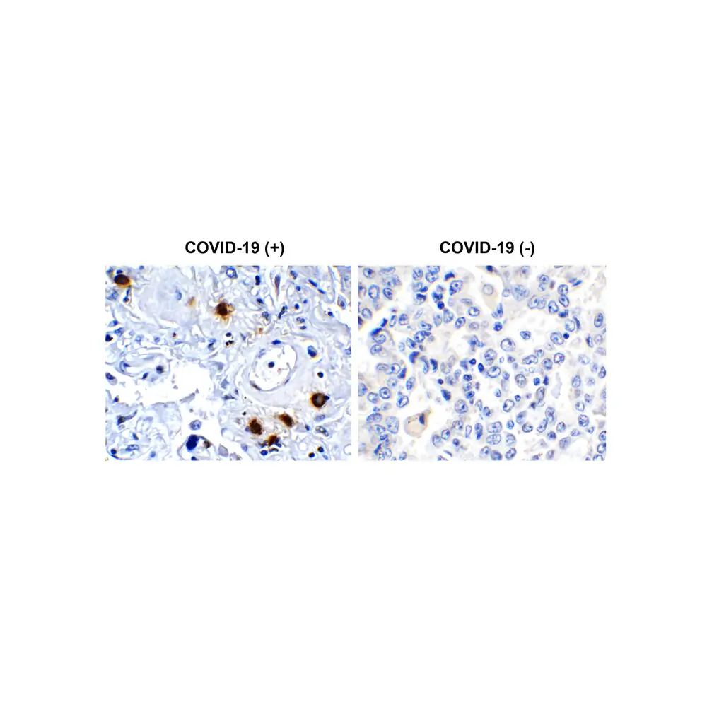 ProSci 9155_S SARS-CoV-2 (COVID-19) NSP7 Antibody, ProSci, 0.02 mg/Unit Primary Image