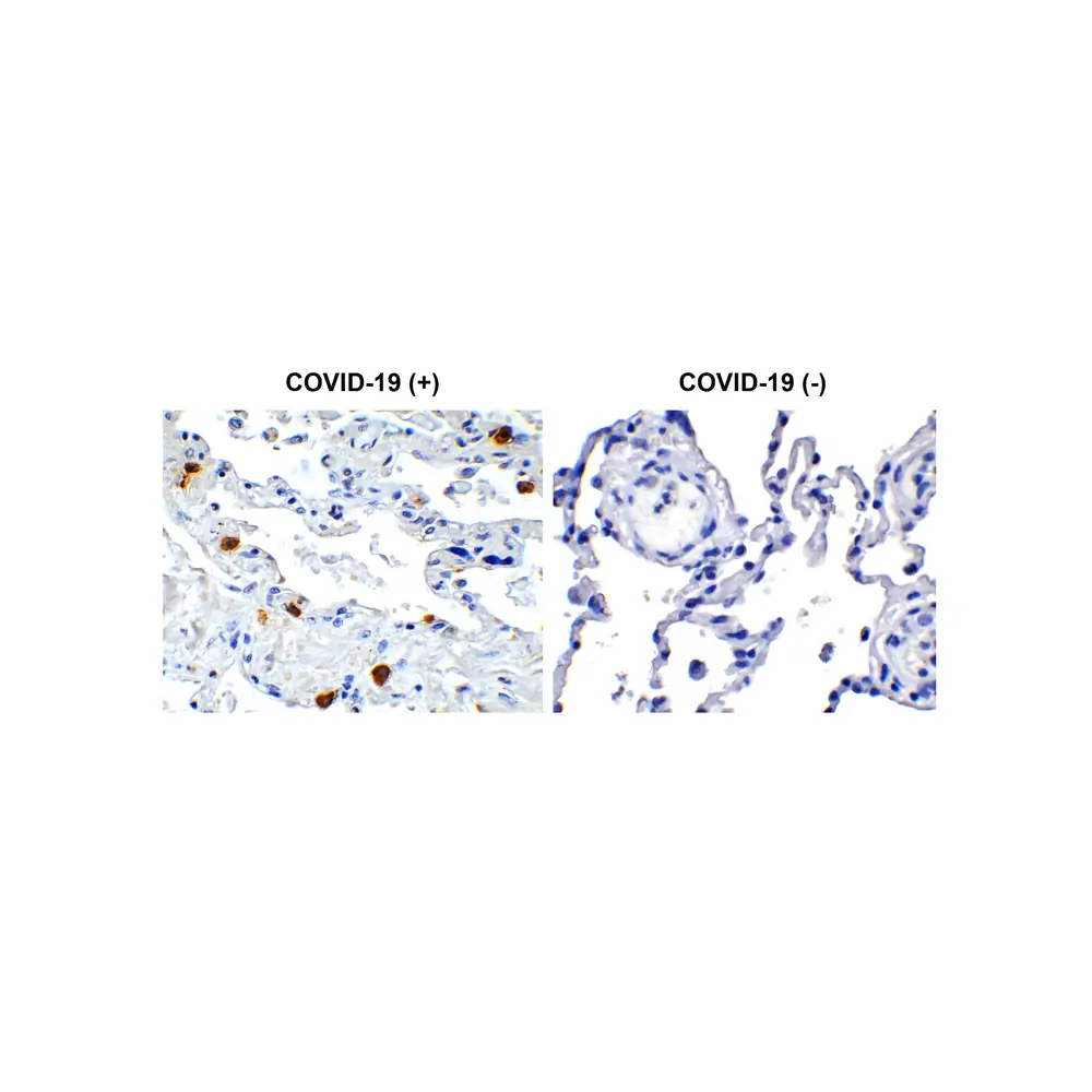ProSci 9159_S SARS-CoV-2 (COVID-19) NSP8 Antibody, ProSci, 0.02 mg/Unit Primary Image