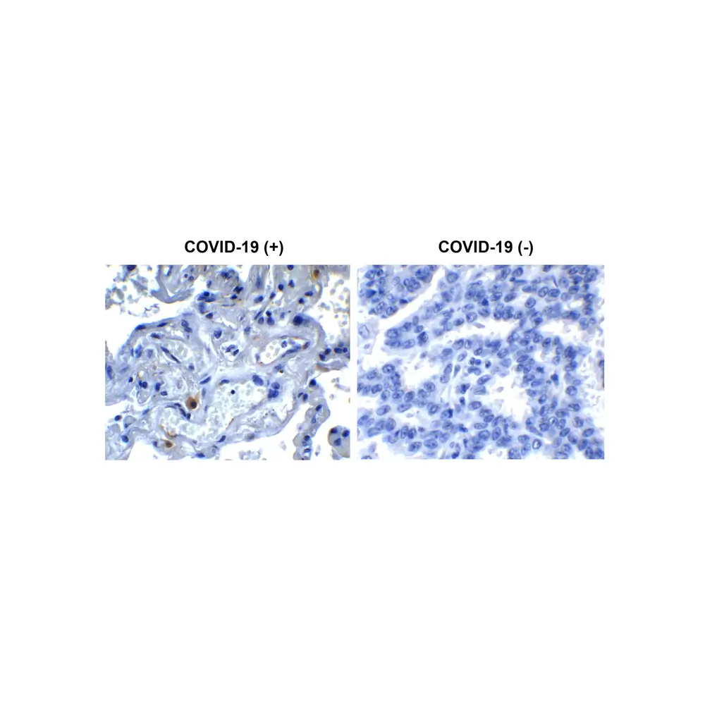ProSci 9161_S SARS-CoV-2 (COVID-19) NSP9 Antibody, ProSci, 0.02 mg/Unit Primary Image
