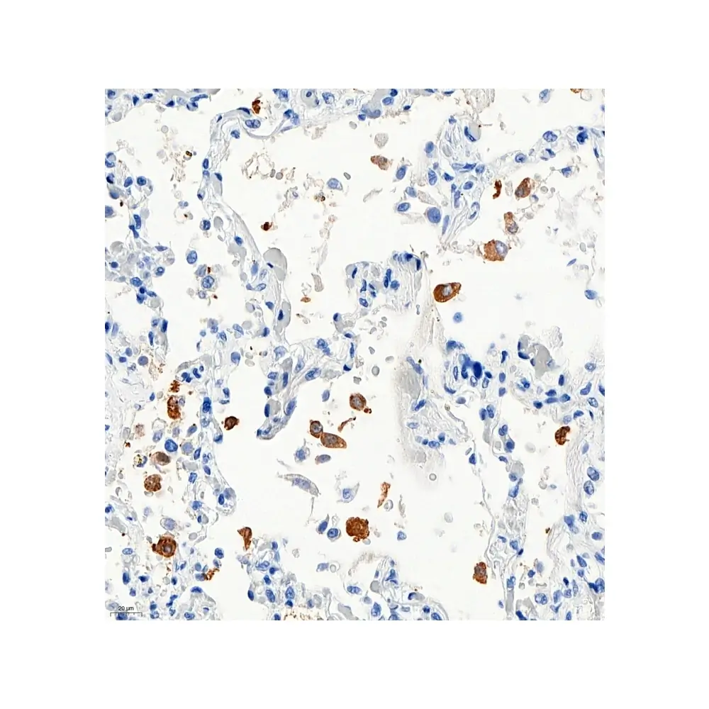 ProSci 9099_S SARS-CoV-2 (COVID-19) Nucleocapsid Antibody, ProSci, 0.02 mg/Unit Secondary Image