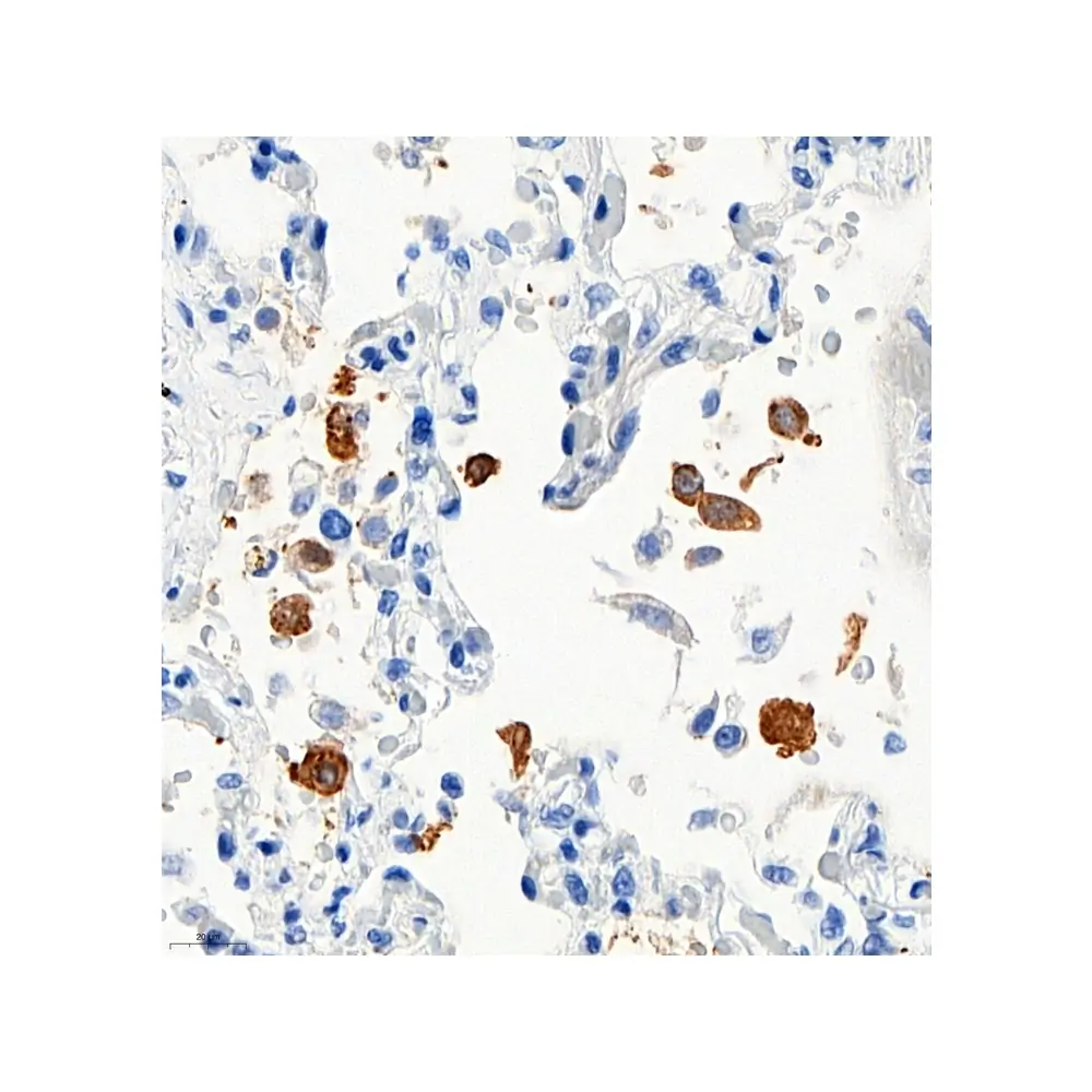ProSci 9099 SARS-CoV-2 (COVID-19) Nucleocapsid Antibody, ProSci, 0.1 mg/Unit Tertiary Image