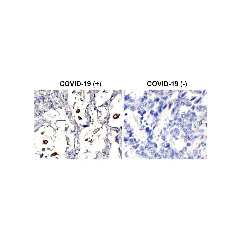 ProSci 9099-HRP_S SARS-CoV-2 (COVID-19) Nucleocapsid Antibody (HRP), ProSci, 0.02 mg/Unit Primary Image