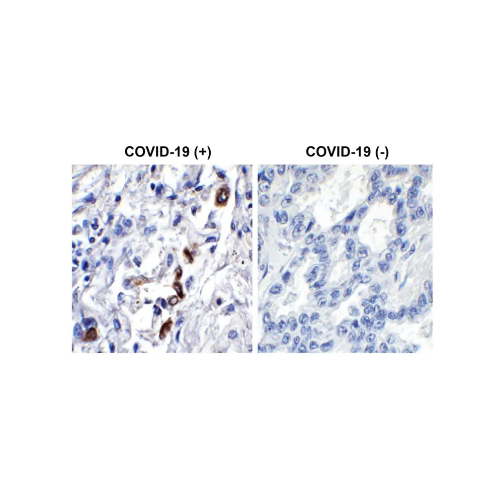 ProSci 9275_S SARS-CoV-2 (COVID-19) ORF3a Antibody, ProSci, 0.02 mg/Unit Primary Image