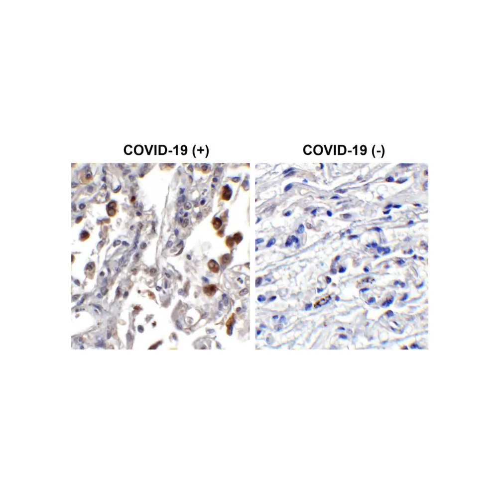 ProSci 9279_S SARS-CoV-2 (COVID-19) ORF3b Antibody, ProSci, 0.02 mg/Unit Primary Image