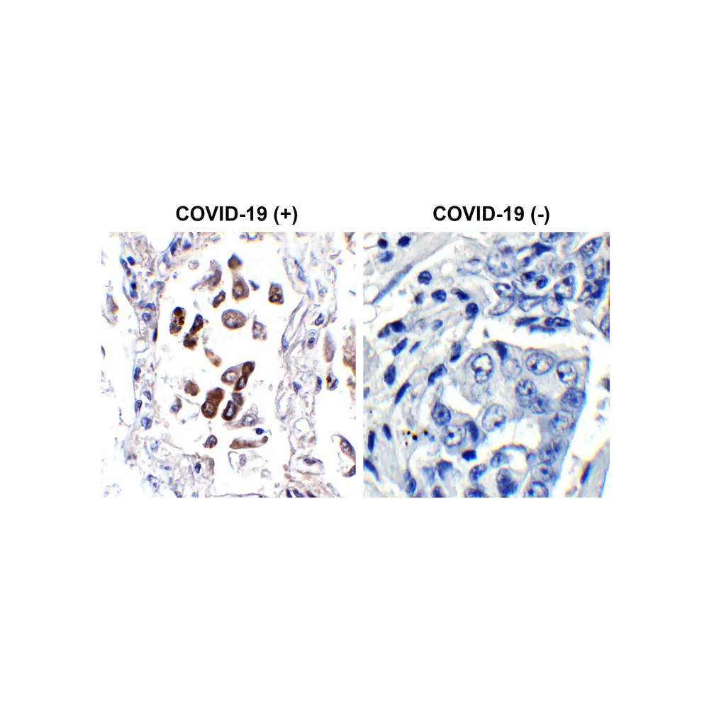 ProSci 9287 SARS-CoV-2 (COVID-19) ORF8 Antibody, ProSci, 0.1 mg/Unit Primary Image