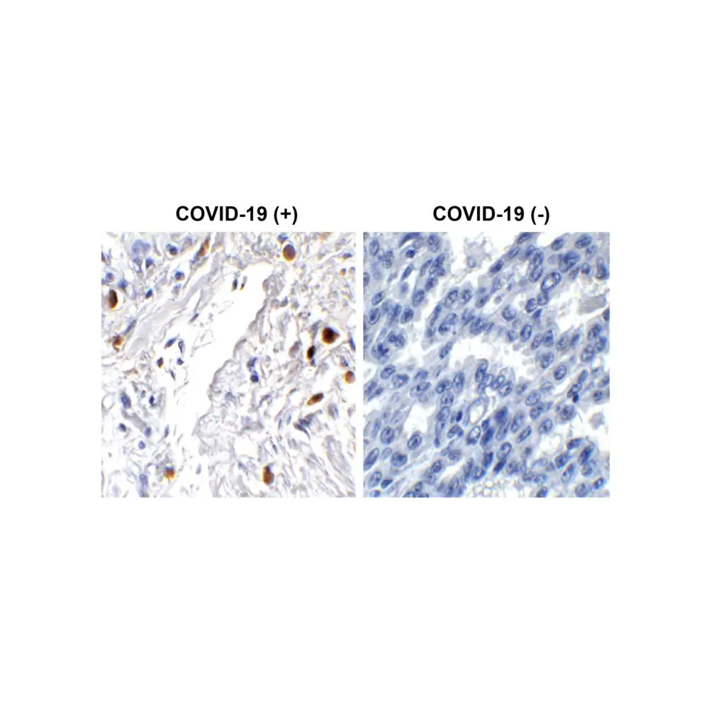 ProSci 9285_S SARS-CoV-2 (COVID-19) ORF7a Antibody, ProSci, 0.02 mg/Unit Primary Image