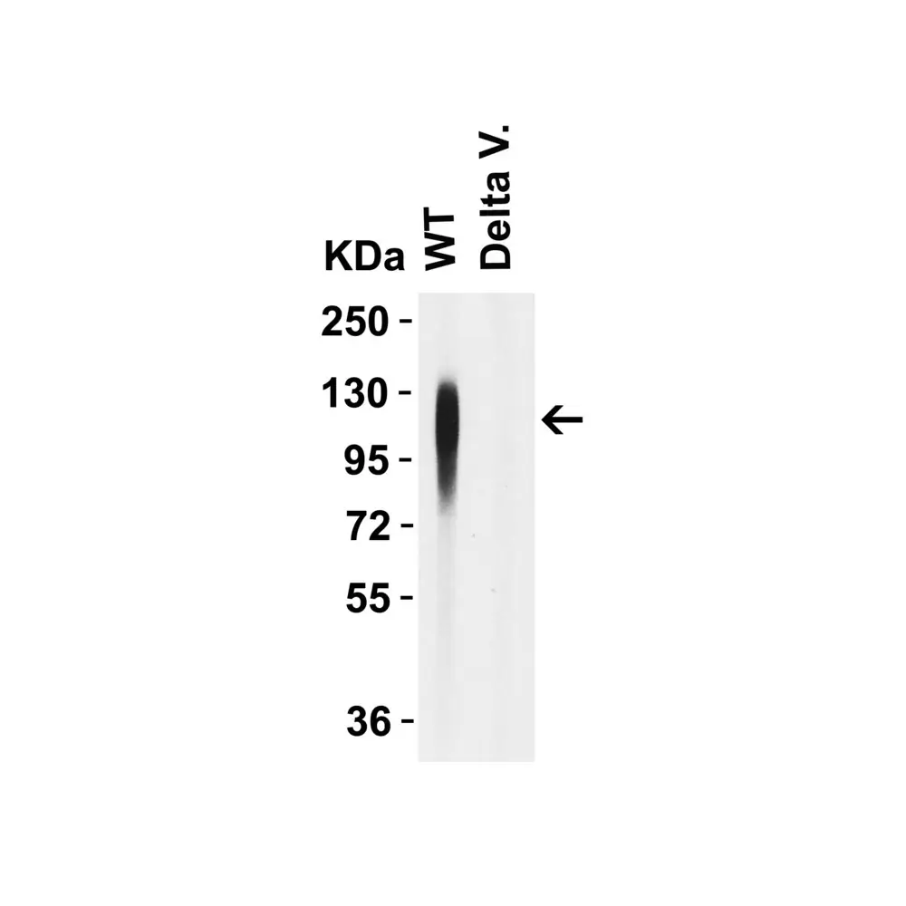 ProSci 9685 SARS-CoV-2 (COVID-19) Spike 156-157EF Antibody, ProSci, 0.1 mg/Unit Secondary Image